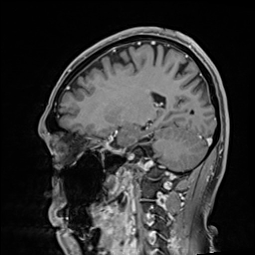 Click on the Serie image to view the images of VILLANUEVA, WILLIAM A.